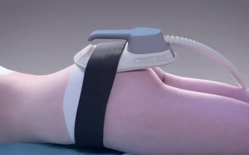 EMSCULPT NEO device on patient's buttocks